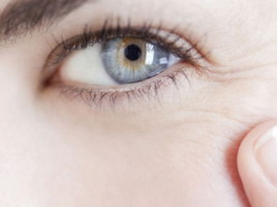 ​眼角纹怎么消除小偏方（生活中五个妙招让你轻松消除眼角纹）