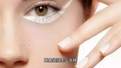 ​眼角细纹怎么去除（多种方法去除眼角细纹）