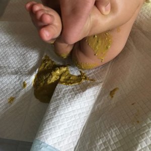 ​小孩子吃到屎怎么办（小孩子吃到大便怎么办）