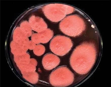 橘子皮上的霉是生物还是非生物污染