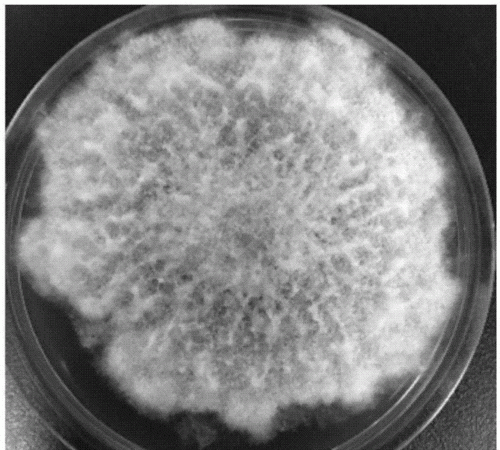 衣服上白色的霉菌是什么