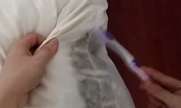 床单发霉了很多黑点怎么洗掉,床单发霉了怎么才可以洗掉呢图5