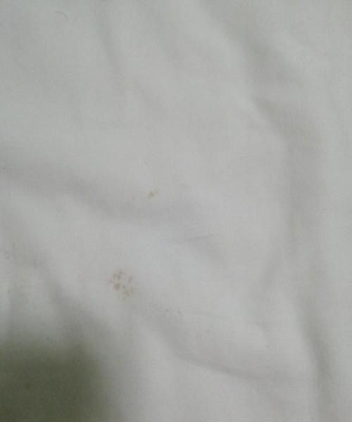 床单被罩有霉点了怎么洗掉