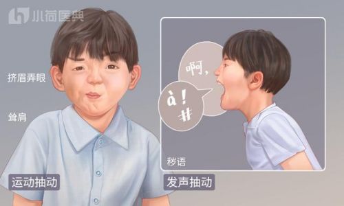 做鬼脸表示什么意思(男人做鬼脸是表示什么)-第1张图片-