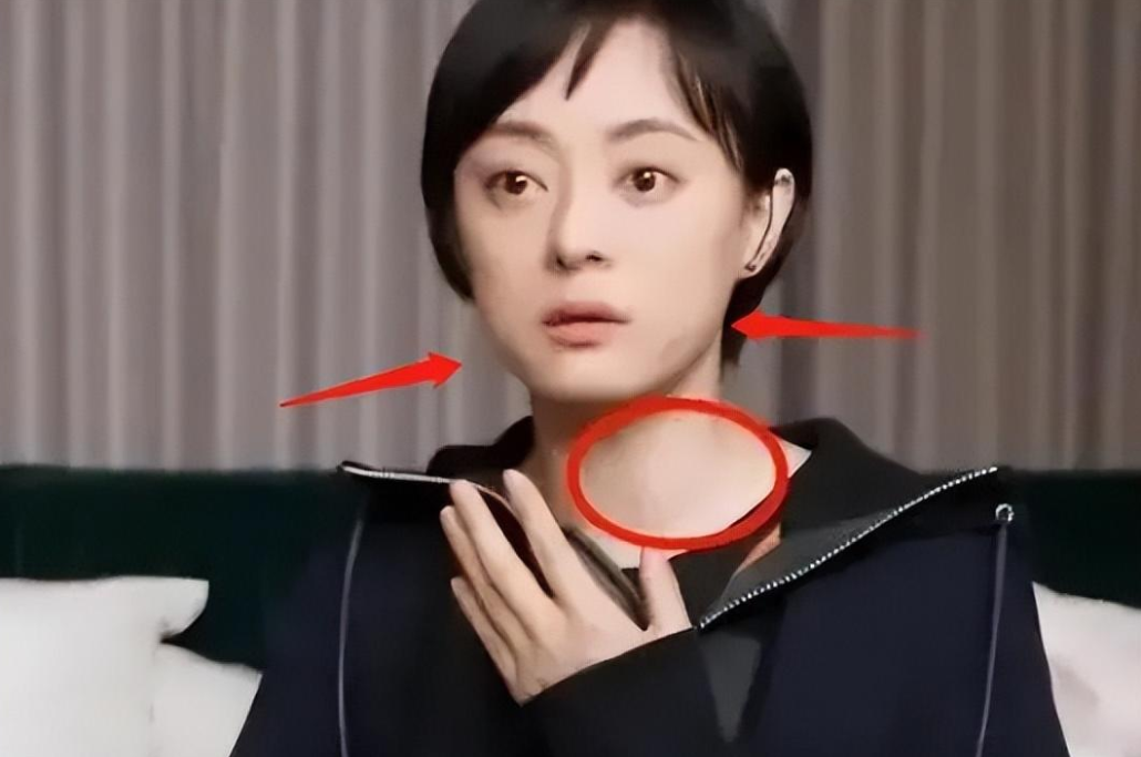 谢娜孙俪成红毯亮点，生图嘴歪脸斜疑毁容，娘娘眼凸脖肿养生过度