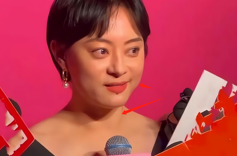 谢娜孙俪成红毯亮点，生图嘴歪脸斜疑毁容，娘娘眼凸脖肿养生过度
