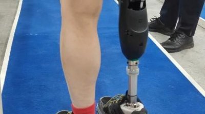 ​北京假肢厂地址(北京假肢厂的联系方式)