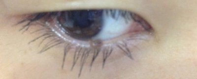 ​下睫毛倒长应该怎么办