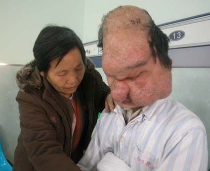 八岁男孩犯病变僵尸视频，中国8岁小孩变僵尸事件-第1张图片-