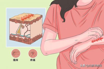 ​常见皮肤疾病有哪些（常见的皮肤病有哪些？该如何分类？日常如何预防？）