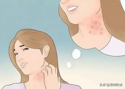 ​湿疹是由什么引起的有什么症状（湿疹发作时，和皮肤以及免疫功能都有相关原因