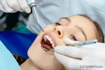 ​洗牙对身体好不好 洗牙的危害大吗
