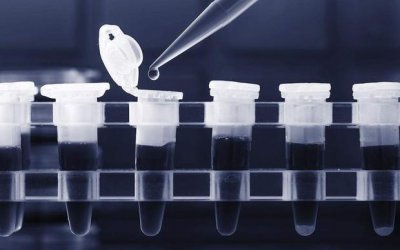 ​PCR实验方法步骤