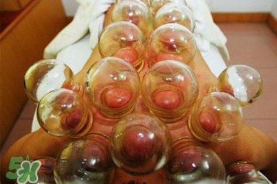 ​冬天可以拔罐放血吗？冬天拔罐放血好吗？