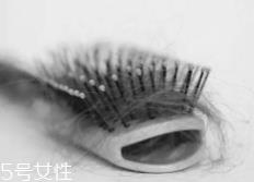 脱发有没有治?只要不是秃子就有得治 脱发有没有治?只要不是秃子就有得治