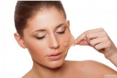 ​熬夜后脸色发黄怎么办 女性脸色发黄怎么办