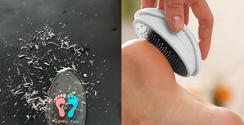 快速去死皮的磨脚器推荐 约会穿凉鞋不尴尬