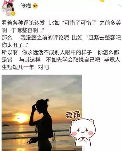 张檬霸气回应“整容事件”，如今假体取出，颜值回到巅峰？