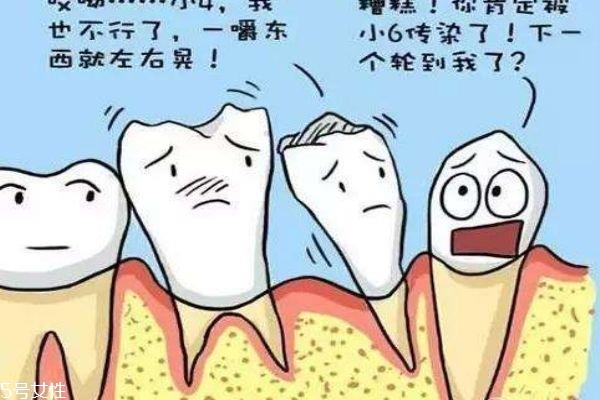 牙齿松动应该怎么办呢 牙齿为什么会松动呢