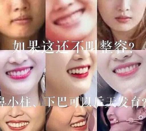 又一个换头宝？吴宣仪被质疑整容痕迹明显，网友：整没整一目了然