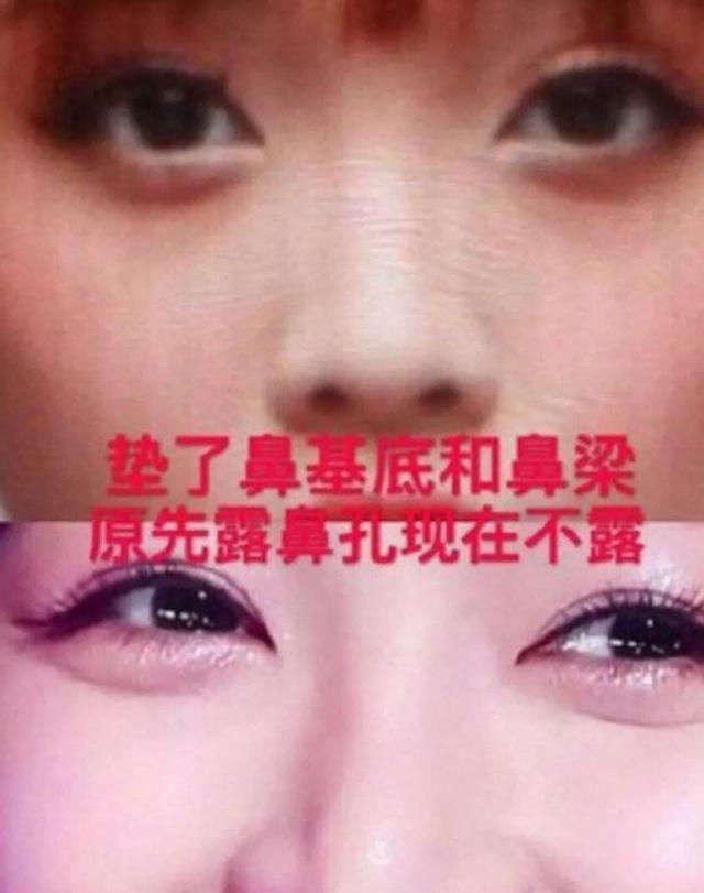 又一个换头宝？吴宣仪被质疑整容痕迹明显，网友：整没整一目了然