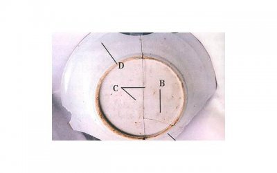 ​男人在婚姻中，为什么爱装傻、敷衍和拖延？