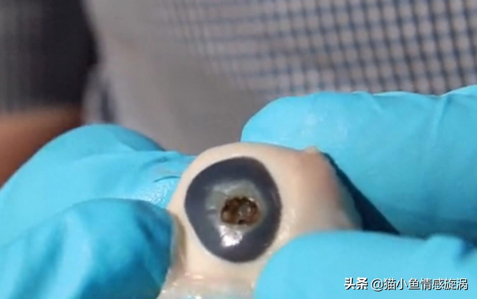 用天文望远镜看太阳会怎么样？老外肉眼亲测，网友：分分钟变瞎子