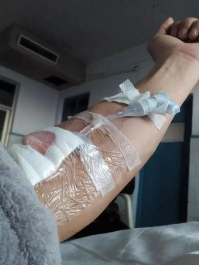 食道癌晚期抗癌成功人士（一位食道癌患者的生存日记）(4)