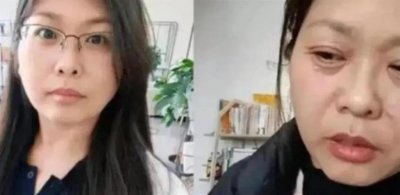 ​“ 20 天老了三十多岁”！女子自称断崖式衰老，专家：男性更早出现