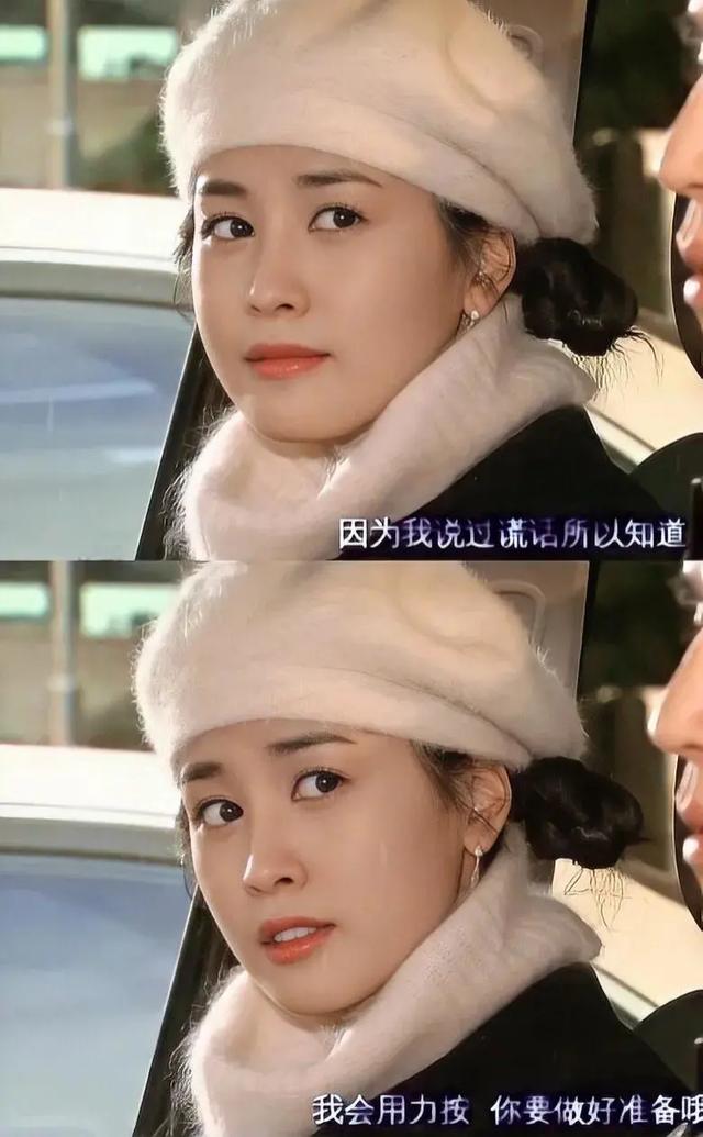 韩国整容最自然最成功的自然人（整容后遗症有多可怕）(6)