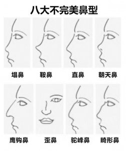 ​细数这8种不完美鼻型，看你中了哪个？