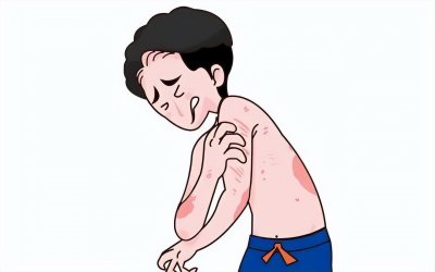 ​速度自查，银屑病好转的六大征兆！