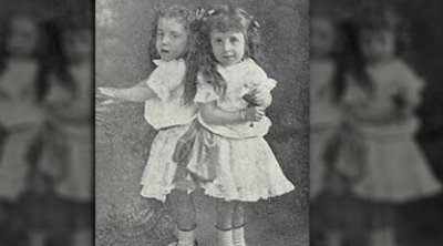 ​英国臀部连体姐妹：各有丈夫，姐姐死后，妹妹与遗体共存2天去世