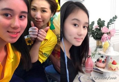 ​矫牙比整容还厉害？9位明星箍牙前后对比，一个个判若两人