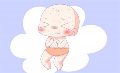 ​宝宝是过敏体质 日常需要注意什么