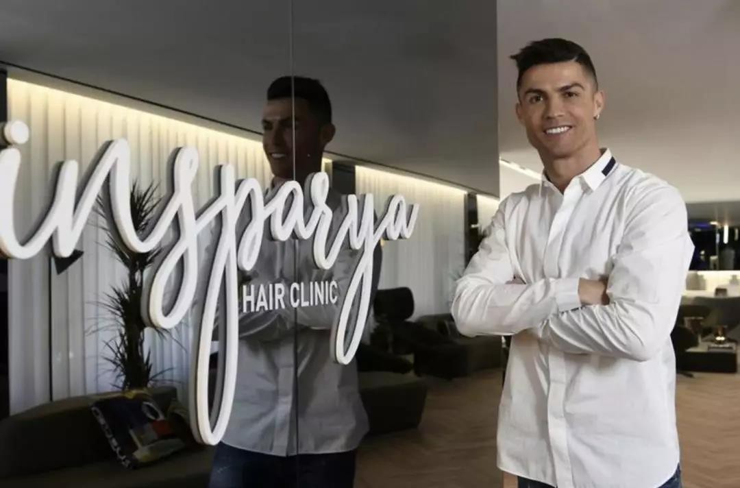 为什么明星秃头不植发(为什么明星不植发) 第2张 为什么明星秃头不植发(为什么明星不植发) 第2张