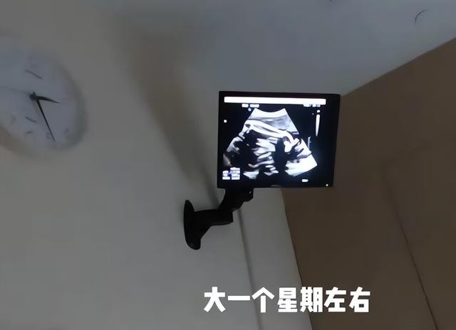 苗苗晒产检vlog官宣怀二胎，隔离期间瘦了与郑恺互诉思念