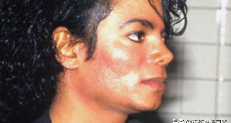迈克杰克逊整容前（迈克杰克逊面容变化史）