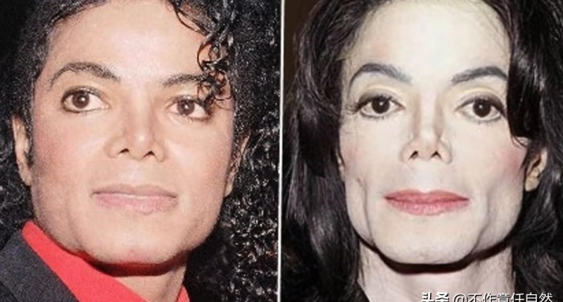 迈克杰克逊整容前（迈克杰克逊面容变化史）