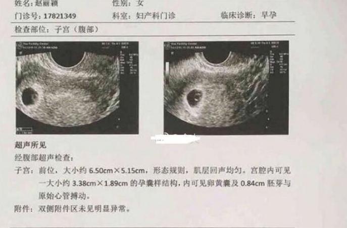 赵丽颖疑似怀孕全过程! 两人结婚后怀孕, 一个套路让人太有好感!