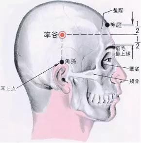 偏头痛快速止痛小妙招（偏头痛者的福音）(3)