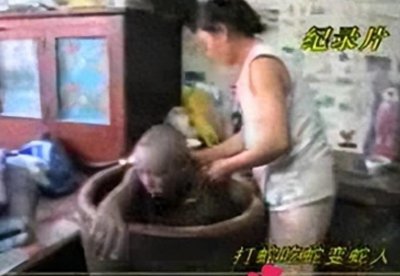 ​蛇肉真的不能吃？辽宁一男子吃蛇变成“蛇人”，身上竟长出了鳞片